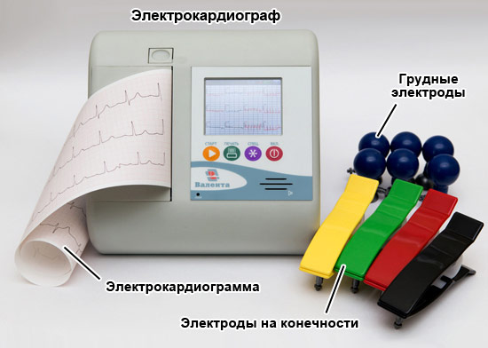 Электрокардиограф